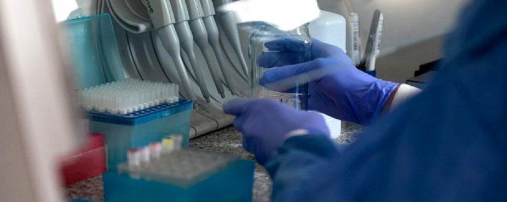 Se realizaron 100.000 ensayos con el test argentino para detectar anticuerpos en el plasma – Télam